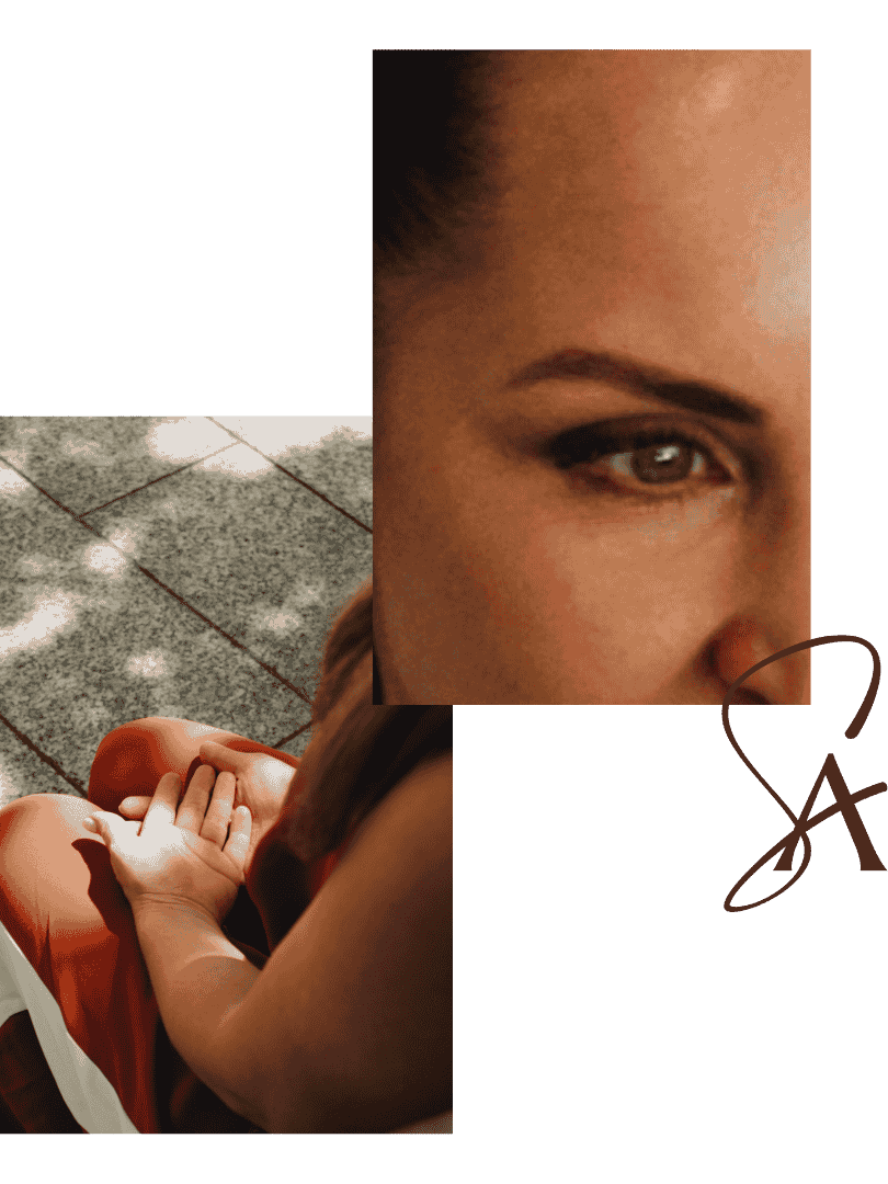 Botox treatment at Sian Aesthetics